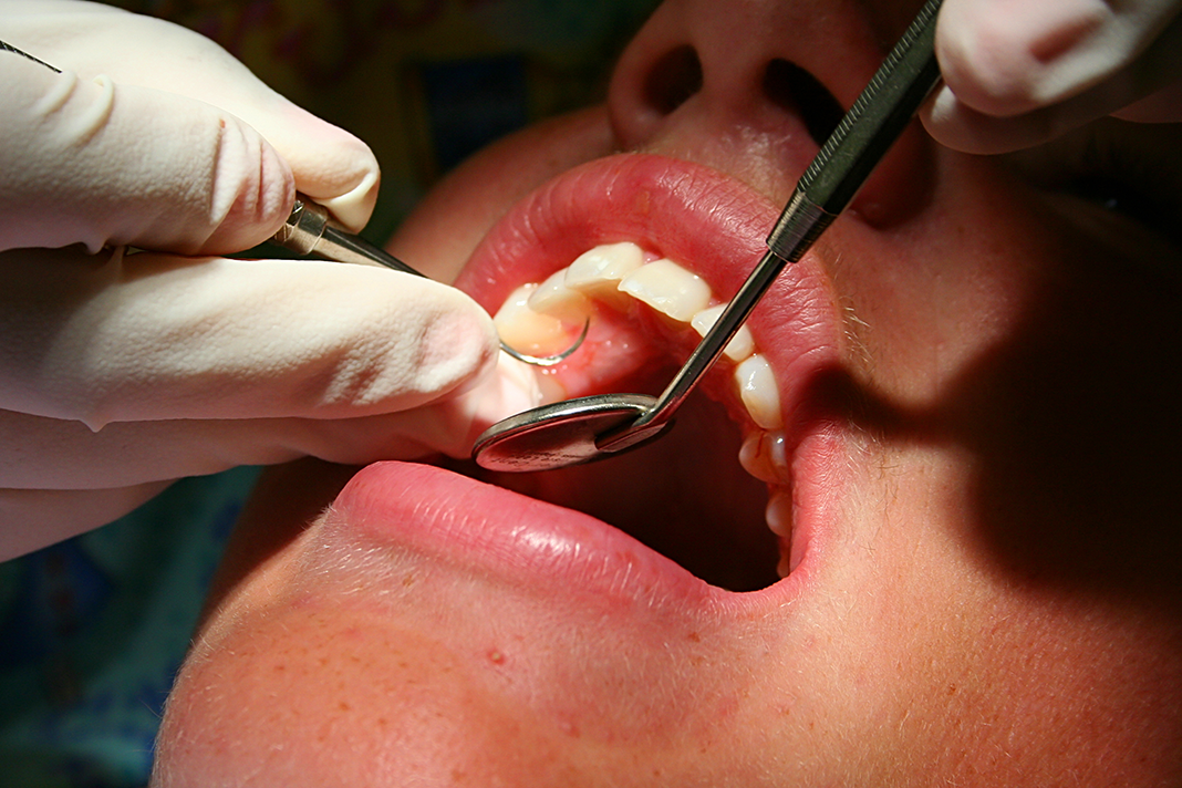 The Many Lives of the Mysterious Full Mouth Debridement - Today&#39;s RDH