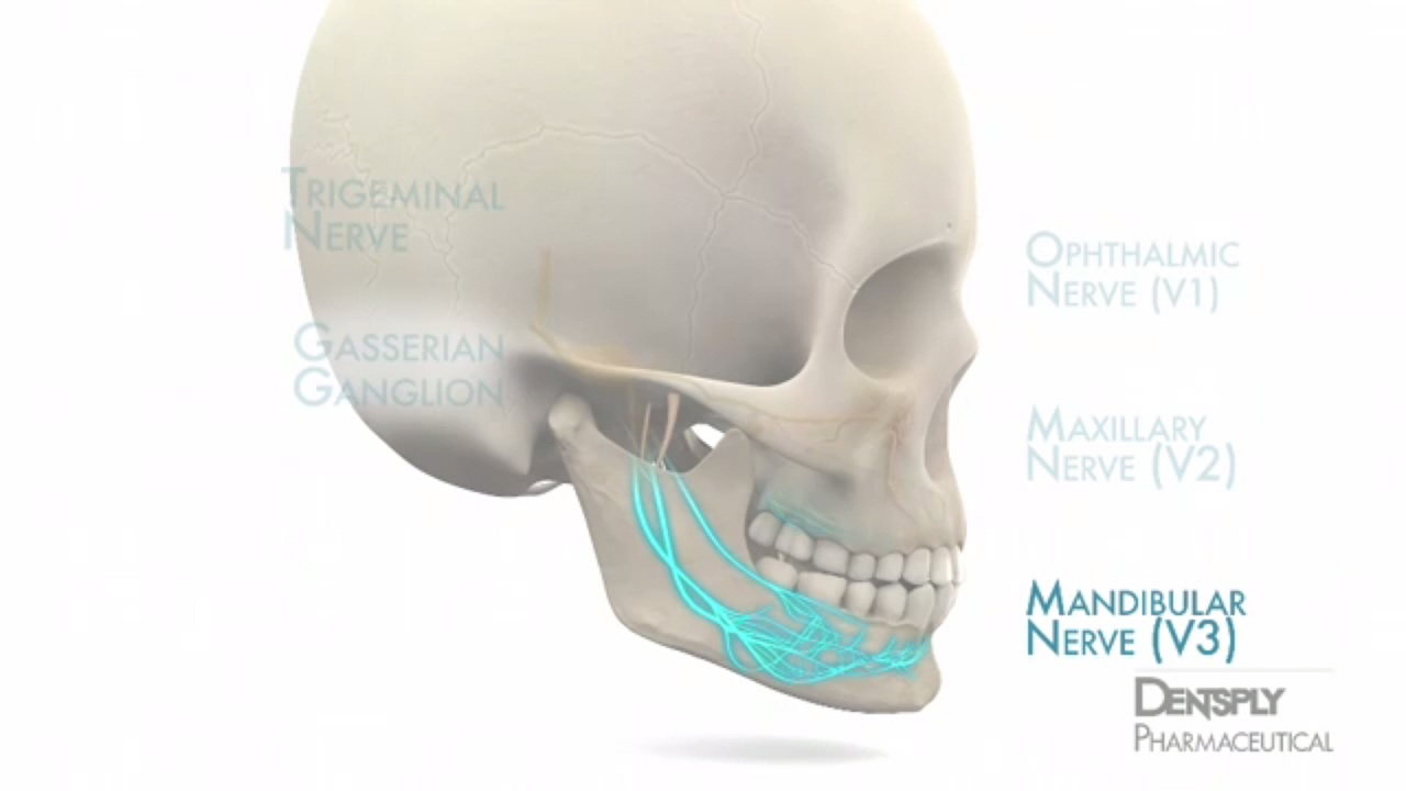 VIDEO Mandibular Anesthesia Injection Techniques Today's RDH