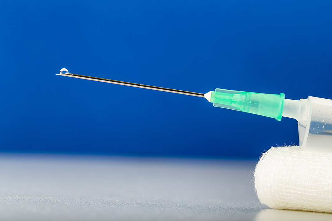 Ask Kara RDH: Anxiety Giving Local Anesthetic - Today's RDH