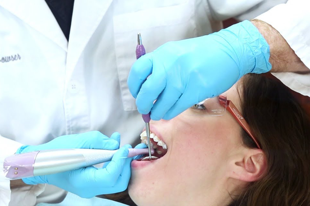 Coronal Polishing Experience the Freedom of Selection Today's RDH