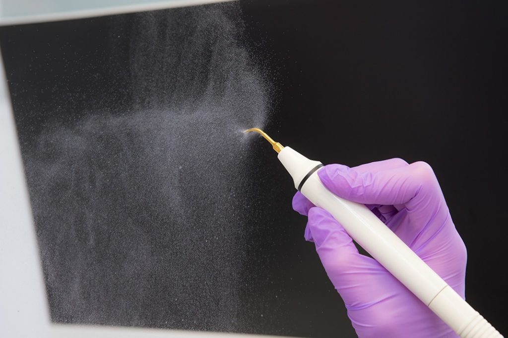 Dentistry’s Aerosols Giving the Dangerous Bugs the Attention they