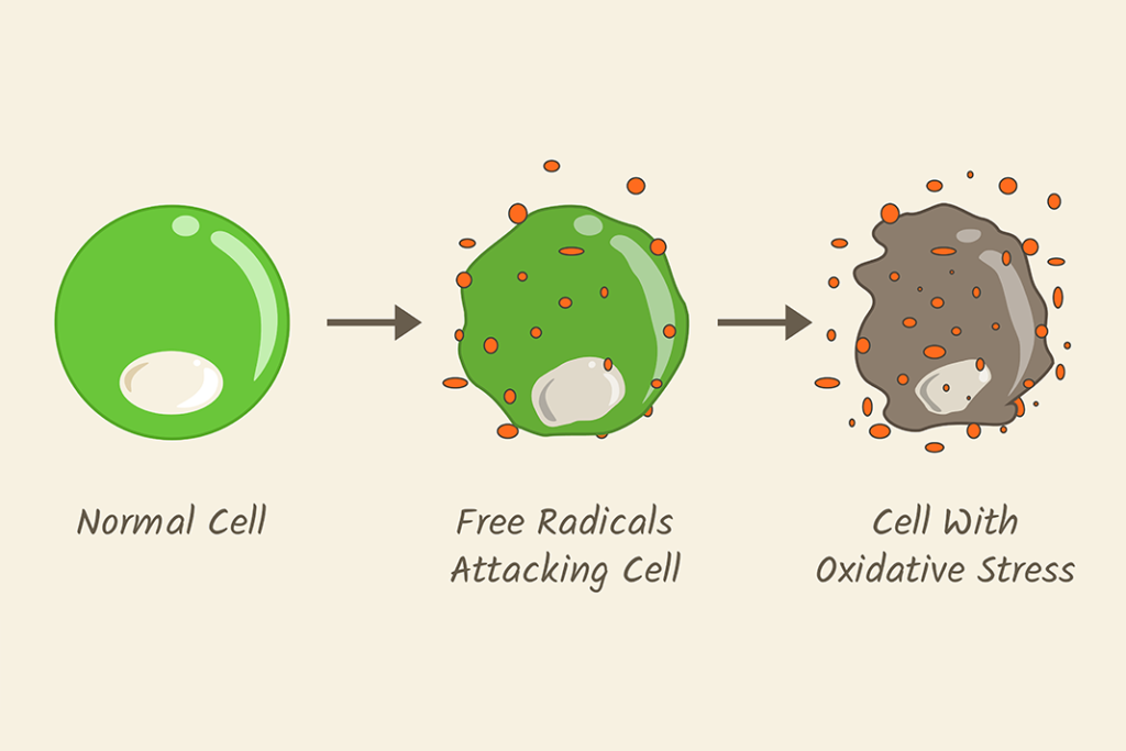 Oxidative Stress Will Future Solutions Launch Antioxidant Therapies