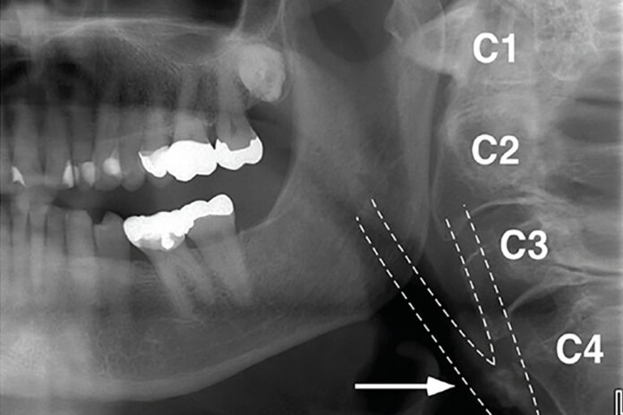 panoramic dental image1